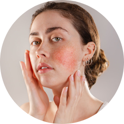 Skin Disorders